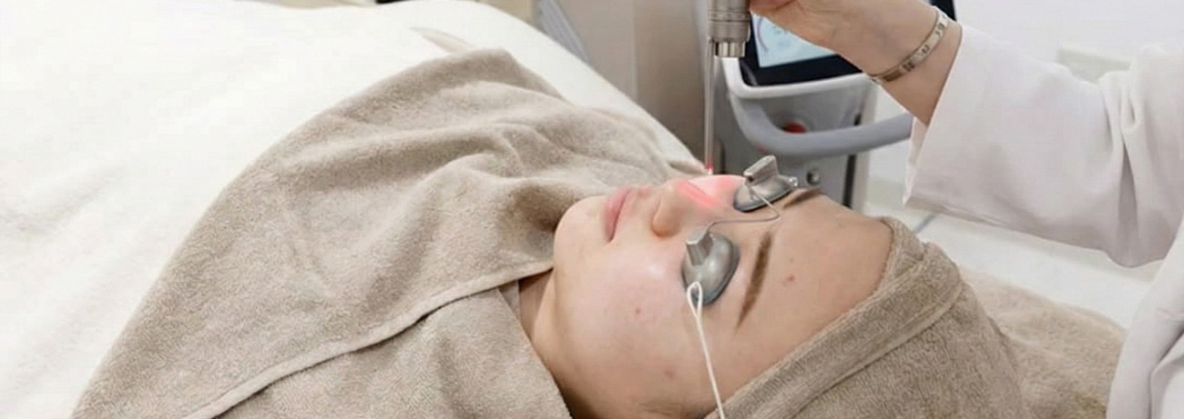 ピコレイザー治療