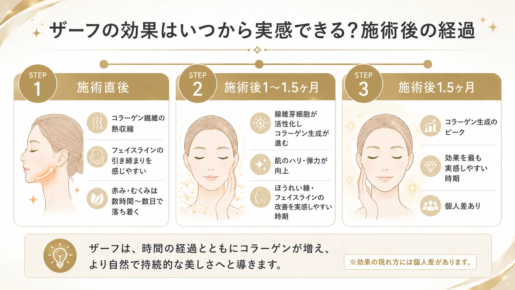 ザーフ施術後の経過を示したインフォグラフィック。施術直後・1〜1.5ヶ月・1.5ヶ月の3ステップで変化を解説。