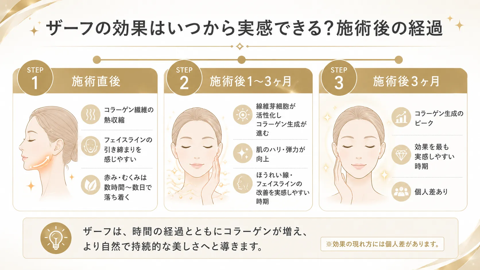 ザーフ施術後の経過を示したインフォグラフィック。施術直後・1〜3ヶ月・3ヶ月の3ステップで変化を解説。