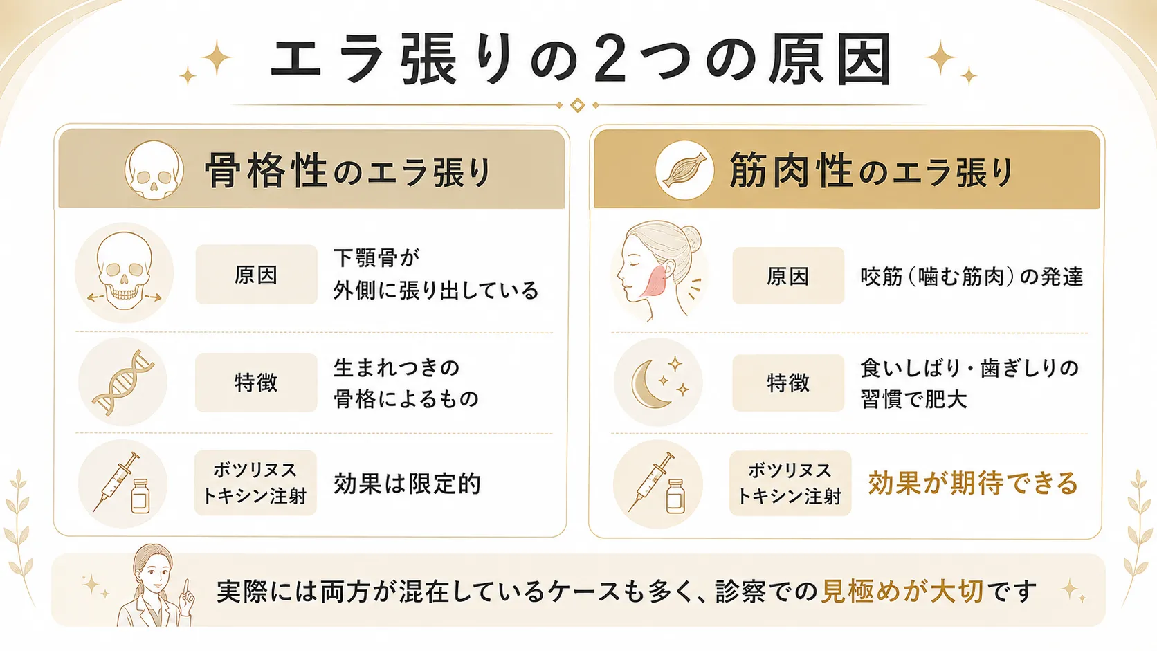 エラ張りの2つの原因を示したインフォグラフィック。骨格性と筋肉性の違いとボツリヌストキシン注射の効果の差を比較