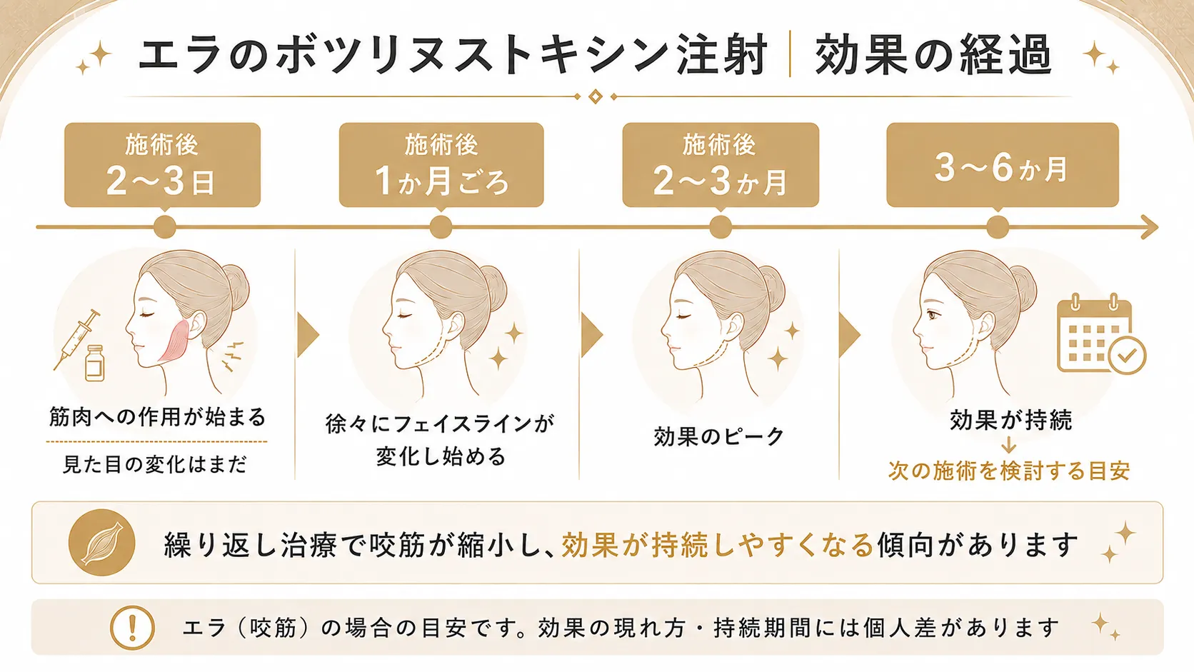 エラのボツリヌストキシン注射の効果の経過を示したインフォグラフィック。施術後2〜3日から3〜6ヶ月までのタイムラインを図解